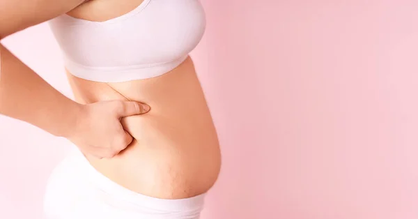 Egy kövér lány fogja a kezét, akinek felesleges zsír van a hasán, rózsaszín háttérrel. a nők életvitelének koncepciója, diétával a hasuk csökkentésére. szülés utáni felépülés. a szöveg helye — Stock Fotó