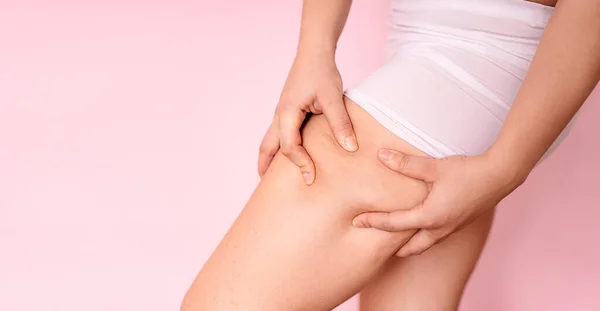 Celulitida nohy ženy Zkušenosti s léčbou tukových stehen. Nadváha liposukce. místo pro text — Stock fotografie