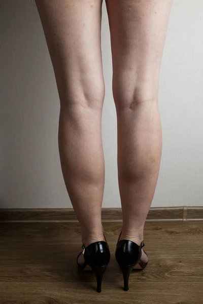 Smukłe Sexy Kobieta Nogi Czarny Sandały Wysokie Obcasy — Zdjęcie stockowe