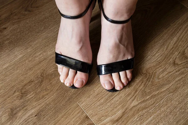 Female Toes Sandals High Heels Close View — Stockfoto