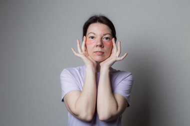 Güzel bir kız estetik ameliyat yapar. Kız göz bandı kullanıyor. Gözlerinin altındaki cilt bakımı.