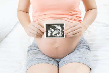 Evde kucağında yatıp ultrason görüntülerini gösteren mutlu hamile kadının hafif odaklanma ve bulanıklığı. Hamilelik, fetal muayene, doğum öncesi bakım, annelik, sağlık, ebeveyn ve aşk.