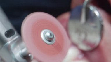 Macro Shot Dentist Working on Patients Teeth
