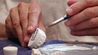 Tracking Close Shot Dental Specialist Working on Implant Prosthetics