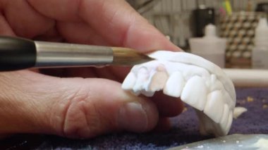 Close Shot Dental Specialist Working on Implant Prosthetics
