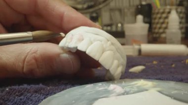 Close Shot Dental Specialist Working on Implant Prosthetics