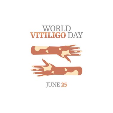 Dünya Vitiligo Günü 'nün vektör grafiği dünya vitiligo günü kutlaması için iyidir. düz dizayn. İlan tasarımı. Düz illüstrasyon.