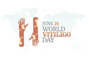 Dünya Vitiligo Günü 'nün vektör grafiği dünya vitiligo günü kutlaması için iyidir. düz dizayn. İlan tasarımı. Düz illüstrasyon.