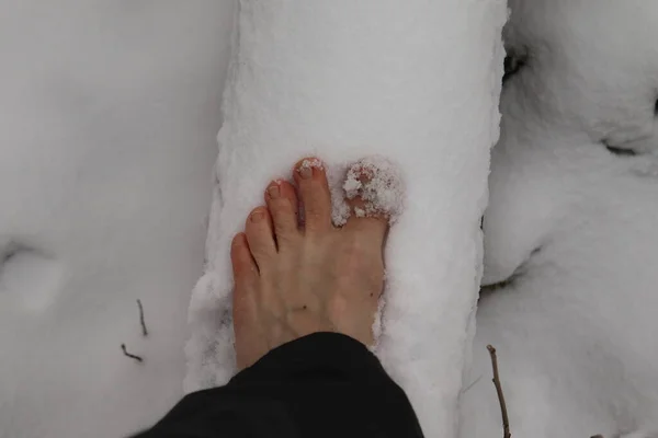 Step right. Bare foot in the snow. Go barefoot on a snowy log.