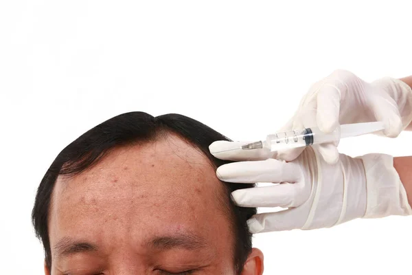 Asijský Muž Injekce Vypadávání Vlasů Injekce Léčbě Akné Obličej Lékařem — Stock fotografie