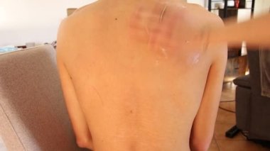 Bir insanın sırtına merhem süren kadın. 