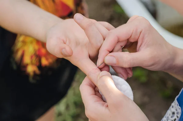 Žena Snaží Vytrhnout Třísku Ruky Teenagera Shard Child Hand — Stock fotografie