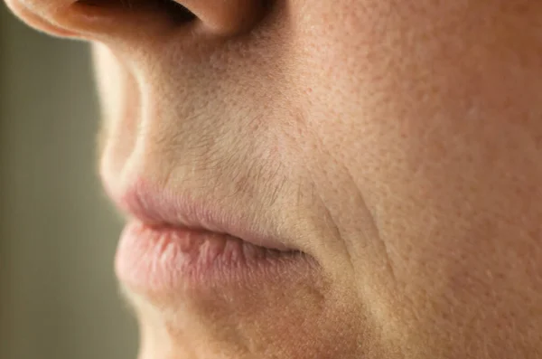Female mustache close-up. Mustache above the upper lip of a woman, close-up, selective focus