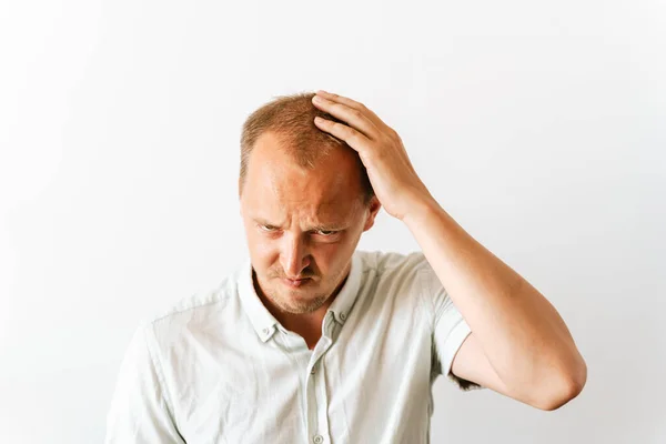 Young sad bald man with depression at hair loss problems looking angry and frustrated and holding his head. Before hair transplantation.