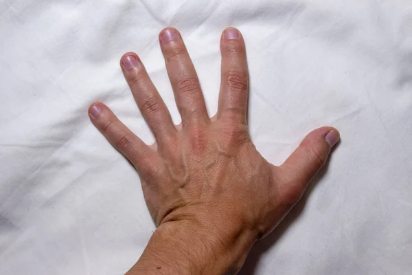 Foto Uma Mão Para Cotovelo Mostrando Veias Veias Covid Vacinação — Fotografia de Stock