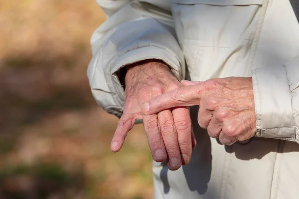Old Man Points His Finger Wedding Ring Should — Stock Photo, Image