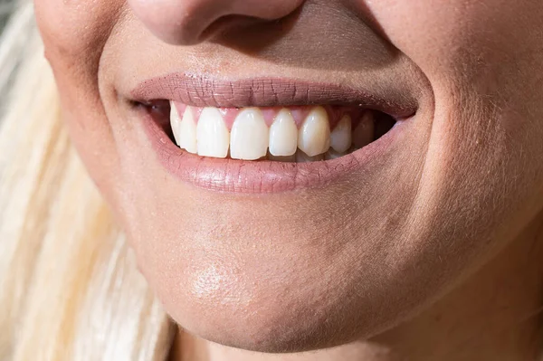 smiling mouth of girl with very white teeth blonde hair