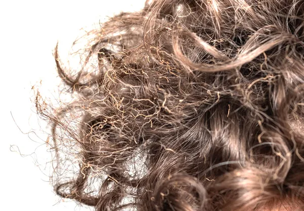 Жженые Волосы Голове — стоковое фото