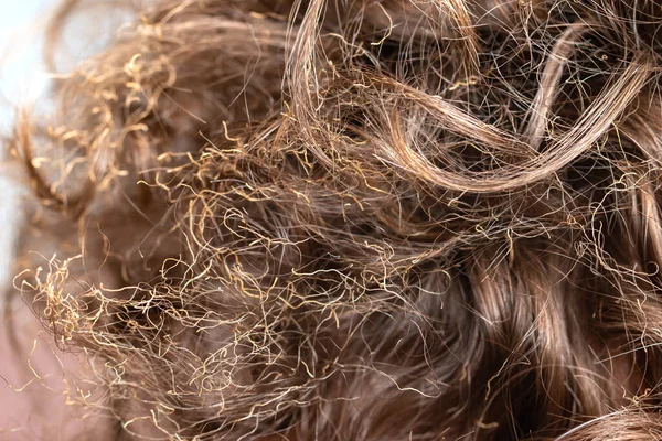 Pelo Quemado Cabeza — Foto de Stock