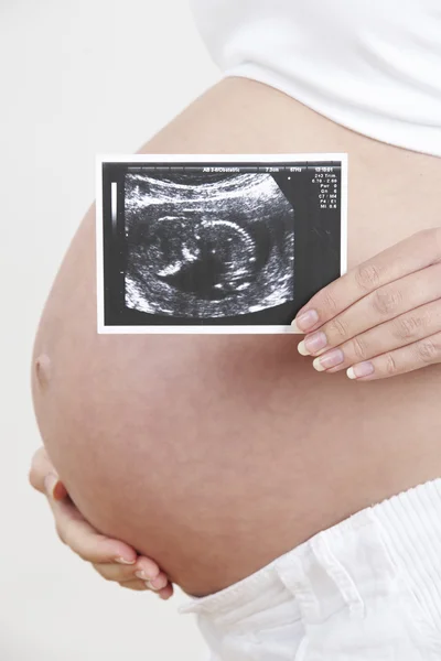 Close Up di donna incinta che tiene ecografia Scansione Fotografia Stock