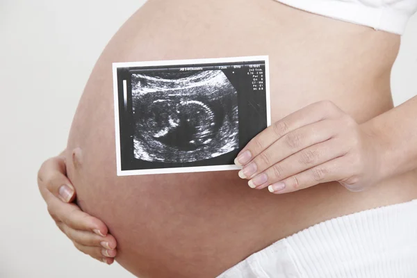 Primer plano de la mujer embarazada sosteniendo la exploración del bebé —  Fotos de Stock