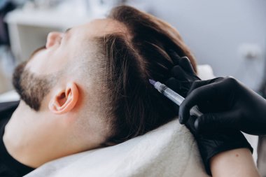 Mezoterapi prosedürü. Bir kozmetik uzmanı genç bir adamın kafasına mezoterapi uygular. Kılların güçlenmesi ve büyümesi.