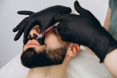 Erkekler için dudak büyüklüğü arttı. Genç, şık sakallı bir kadının dudaklarına hyuleronik asit enjekte edildi.