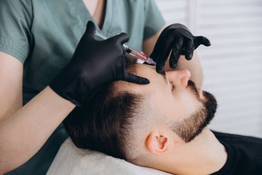 Erkek saçı için mezoterapi. Çekici bir adam kafasından iğne vuruluyor. Güzellik salonunda mezoterapi gören bir adam, şırıngalı koruyucu eldivenli bir terapist, fotokopi odası.