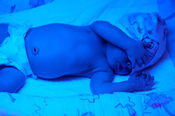 New born baby under the ultraviolet lamp. — Stock Fotó