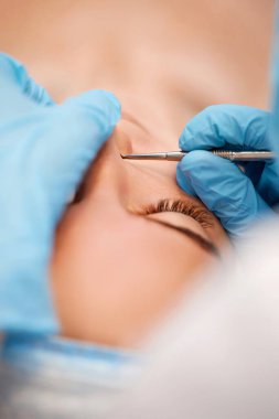 Güzellik kliniğinde mekanik yüz temizleme işlemi sırasında genç bir kadın. Kozmetik uzmanı siyah noktalardan ve sivilcelerden alınan çelik aletlerle derinin temizlenmesi için işlem yapıyor.