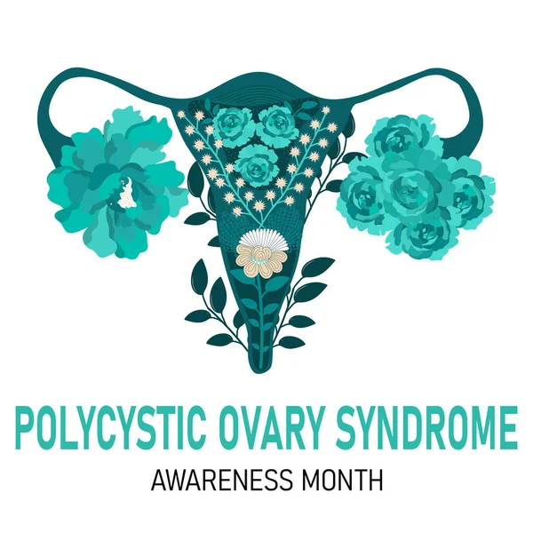 Polycystic Ovary Syndrome Month Vector Cartoon Illustration Uterus — Stok Vektör