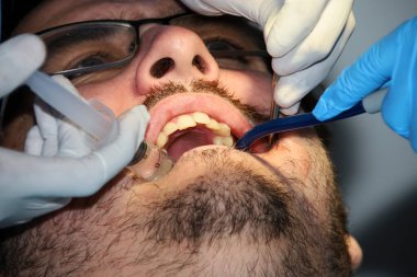 Hafif sakallı bir adam diş tedavisi görüyor.