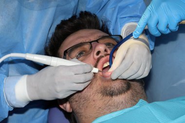 Hafif sakallı bir adam diş tedavisi görüyor.
