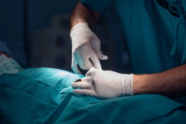 Close up of professional doctors performing operation in surgery room, Healthcare and Medical
