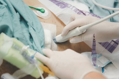 Hasta Asyalı yaşlı kadınlar. 80 'lerin ultrason muayenesi. Doktorun hastanede kullandığı ultrason cihazıyla..