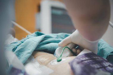 Hasta Asyalı yaşlı kadınlar. 80 'lerin ultrason muayenesi. Doktorun hastanede kullandığı ultrason cihazıyla..