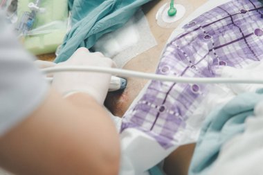 Hasta Asyalı yaşlı kadınlar. 80 'lerin ultrason muayenesi. Doktorun hastanede kullandığı ultrason cihazıyla..