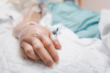 Hasta Asyalı yaşlı kadınlar 80 