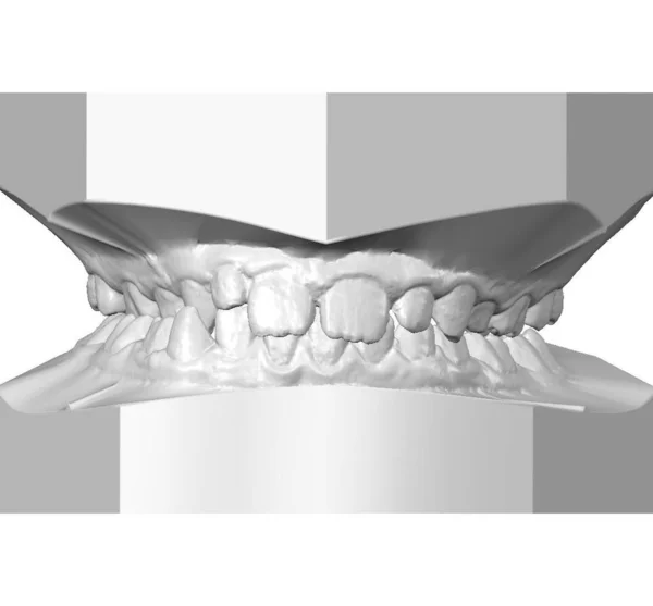 Mandíbula superior e inferior de 9 años chicos 3d foto. Aislado sobre fondo blanco. Práctica dental. — Foto de Stock