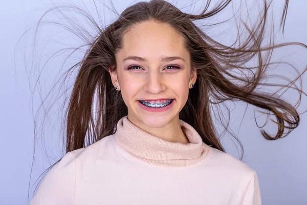 Retrato Uma Jovem Fêmea Sorridente Com Aparelho Conceito Odontológico — Fotografia de Stock