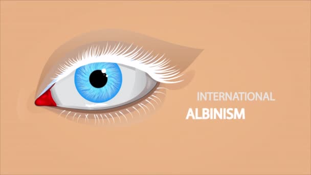 Uluslararası Albinizm Farkındalık Gün Gözü Sanat Videosu Illüstrasyonu — Stok video