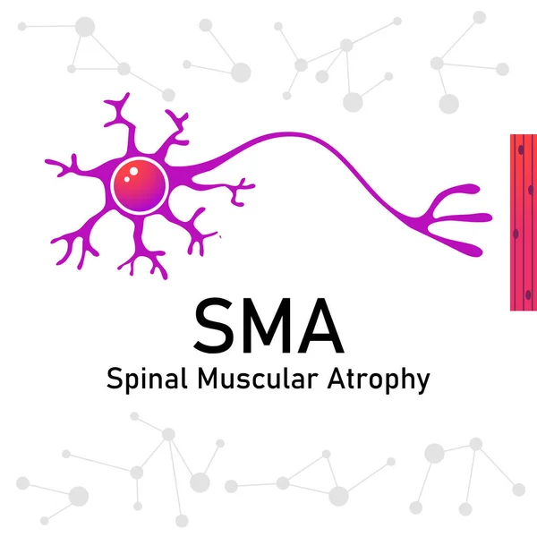 Spinale Spieratrofie Sma Spinal Muscular Atrohy Bewustzijnsmaand — Stockvector