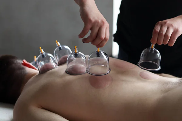 Massage vacuum cups. Close-up of man lying with banks on his back in spa salon. Vacuum jars in treatment and cosmetology. Vacuum therapy. Cup massage.