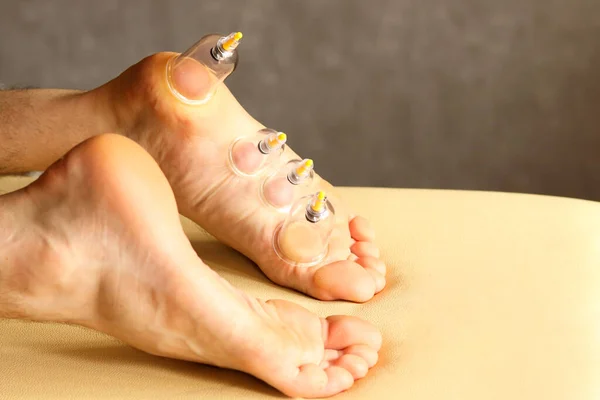 Cupping therapy. Cup vacuum massage. Cups for massage on the man's foot.