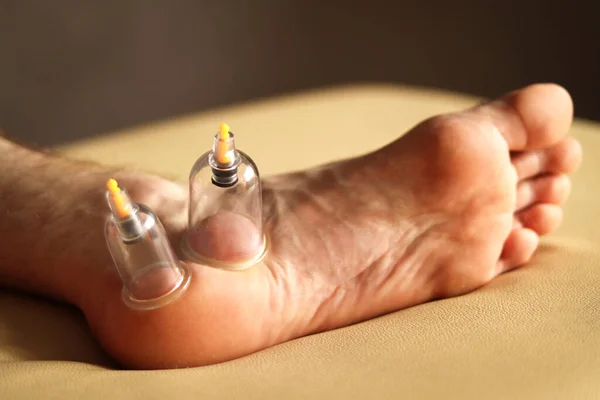 Cupping therapy. Cup vacuum massage. Cups for massage on the man\'s foot.