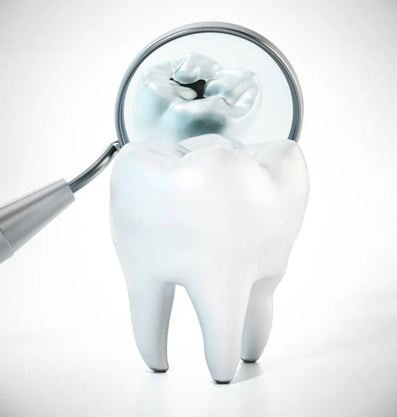 Дзеркало Стоматолога Показує Задню Частину Ізольованого Зуба Ілюстрація — стокове фото