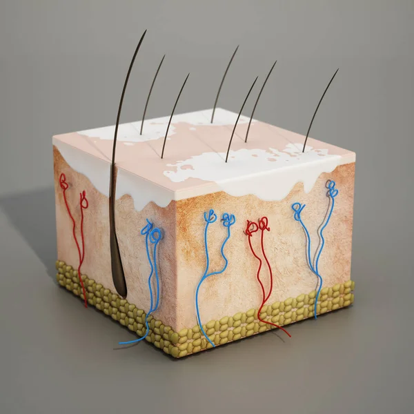 Struktur Mänsklig Hud Avsnitt Med Vitiligo Sjukdom Illustration — Stockfoto