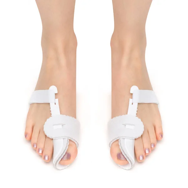 Ön taraftaki kadının ayağında ortoz var. Ağrılı nasırları tedavi etmek ve yardım etmek için ve baş parmağında Hallux Valgus