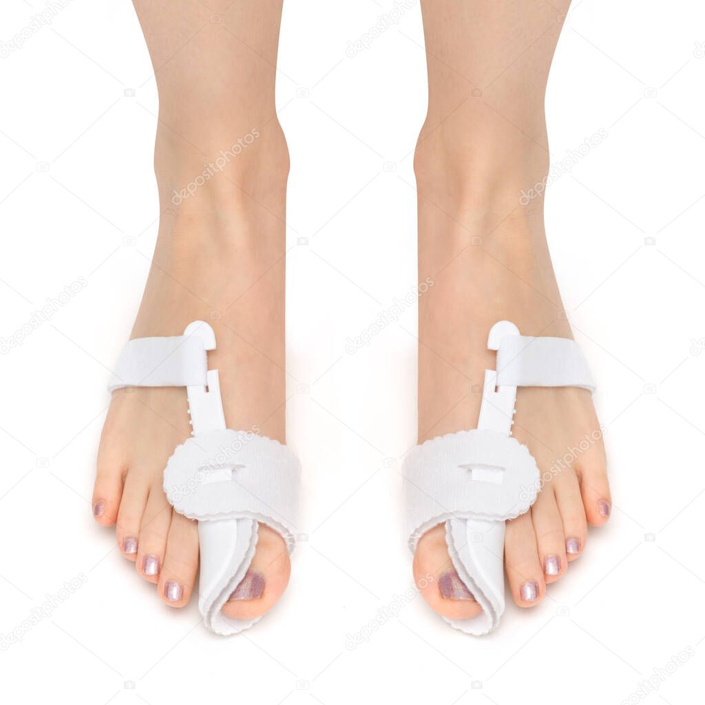 orthosis on the woman's foot on the front. The solution to treat and help with painful bunions and Hallux Valgus on big toe