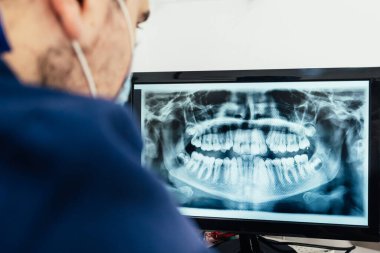 Bir diş kliniğindeki bilgisayar ekranında panoramik röntgen incelemesi yapan bir dişçi..